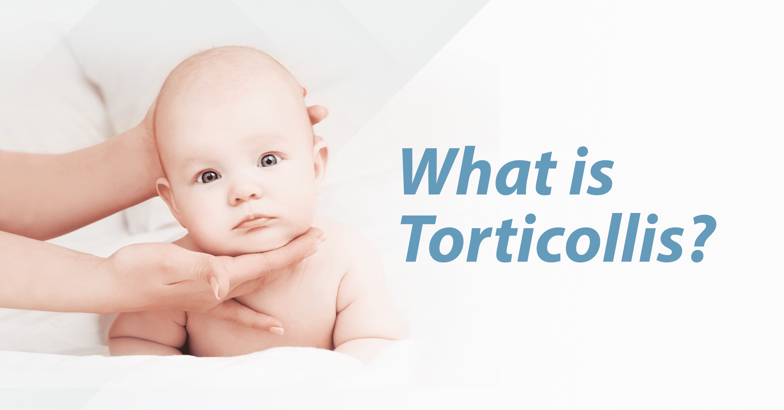 How To Treat Torticollis In Adults