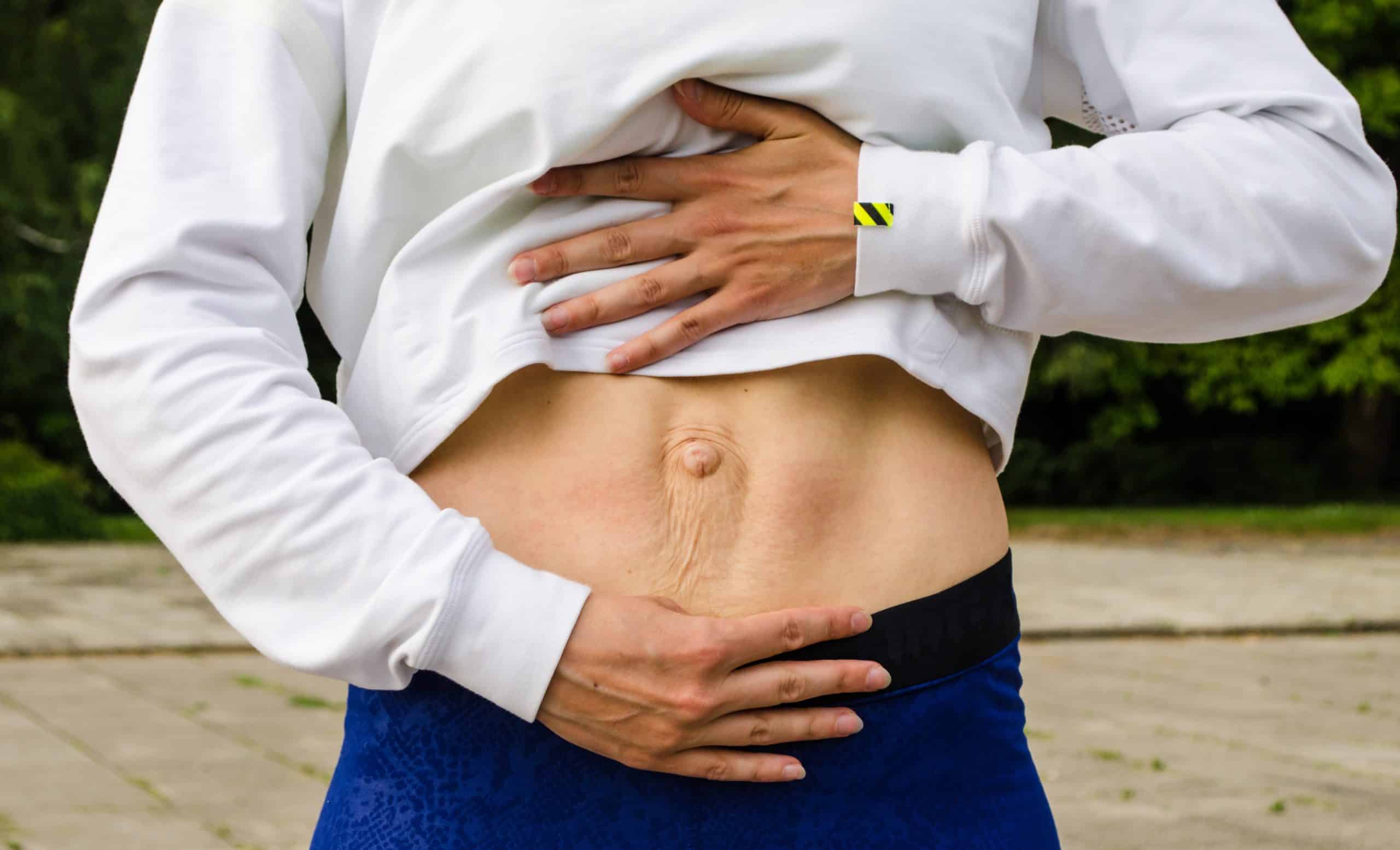 Why Do Men Get Abdominal Separation And Why Does It Lead To Back